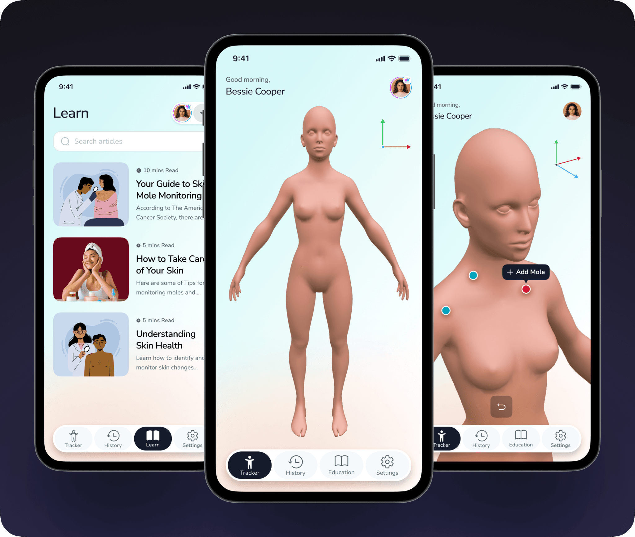 Trust-Centered UX for Mole Monitoring